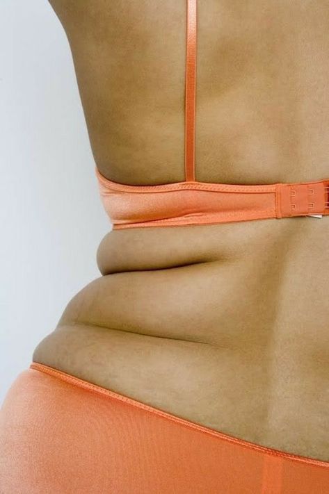 Natural Approaches for Polycystic Ovarian Syndrome (PCOS)