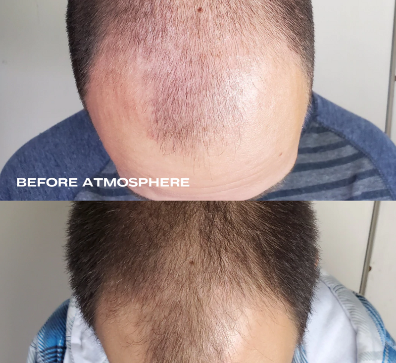 Atmosphere Hair Density & Scalp Serum 2.03 floz